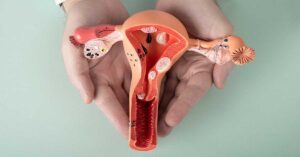 O Que é endometriose Entendendo a doença e seus sintomas